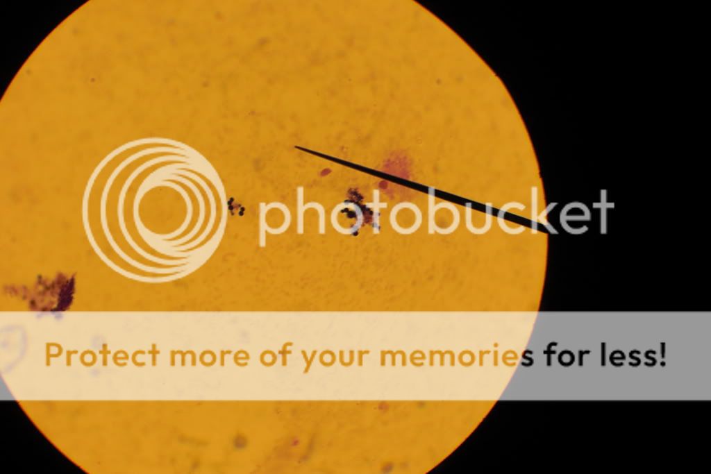 Bacteria 100x